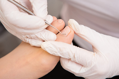 chiropody